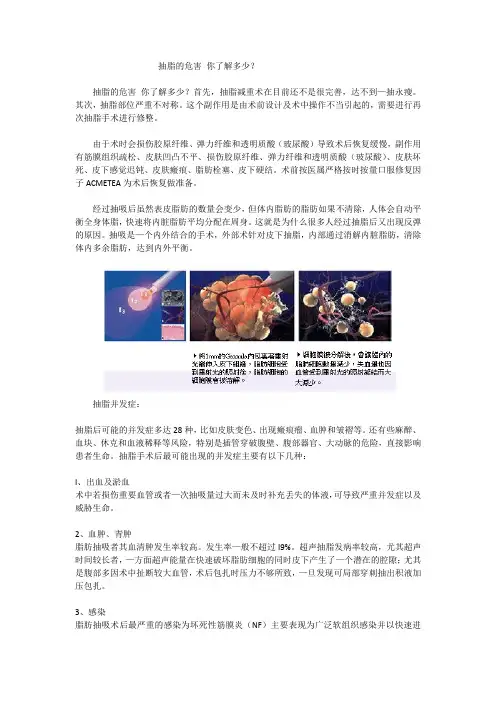 抽脂的危害 你了解多少
