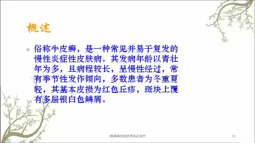 银屑病的临床表现及治疗课件