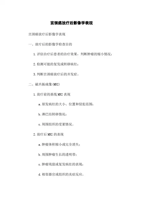 宫颈癌放疗后影像学表现