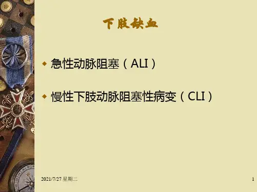 齐鲁医学下肢缺血讲义.pptx