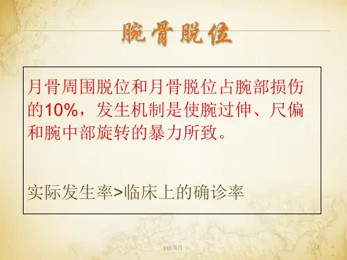 关于腕骨脱位  ppt课件