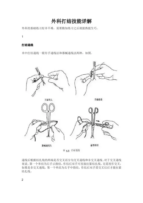 外科打结技能详解