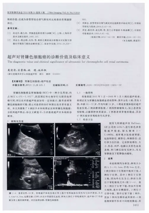 超声对肾嫌色细胞癌的诊断价值及临床意义