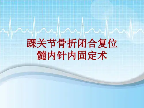 手术讲解模板：踝关节骨折闭合复位髓内针内固定术