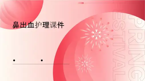 鼻出血护理课件