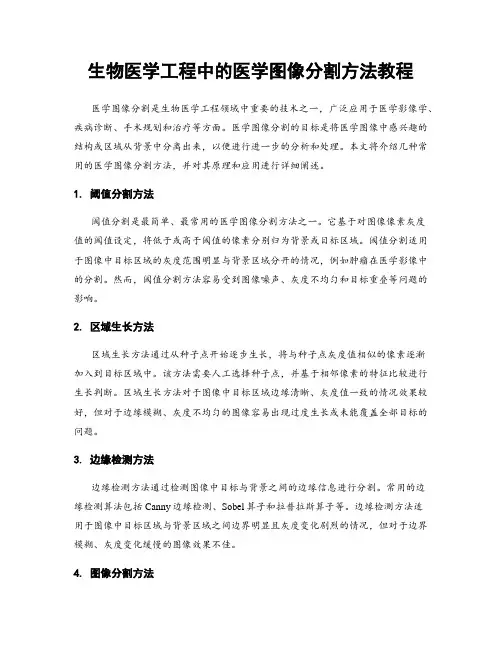 生物医学工程中的医学图像分割方法教程