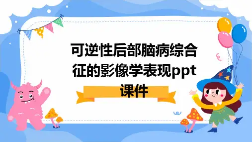 可逆性后部脑病综合征的影像学表现PPT课件