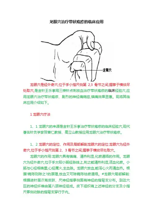 龙眼穴治疗带状疱疹的临床应用