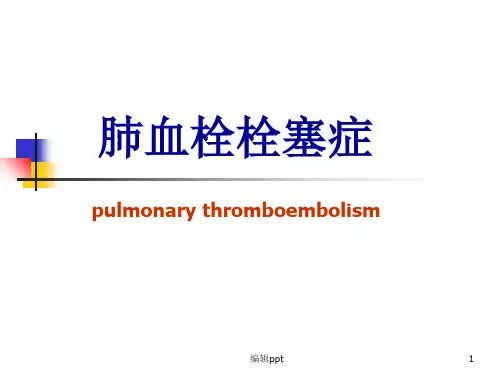 肺血栓栓塞症