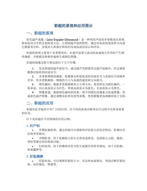 彩超的原理和应用图示