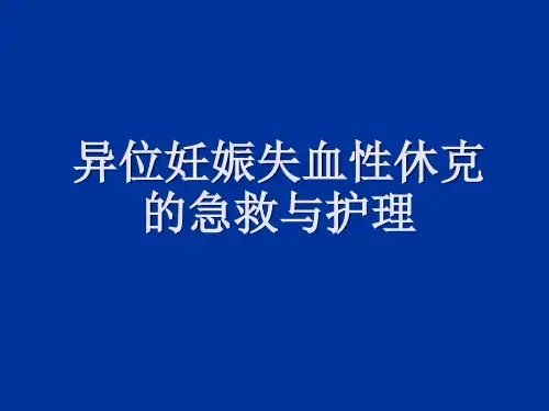 异位妊娠失血性休克的急救与护理护理查房
