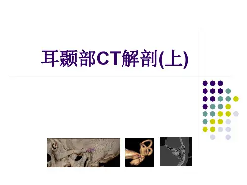 耳颞部影像解剖