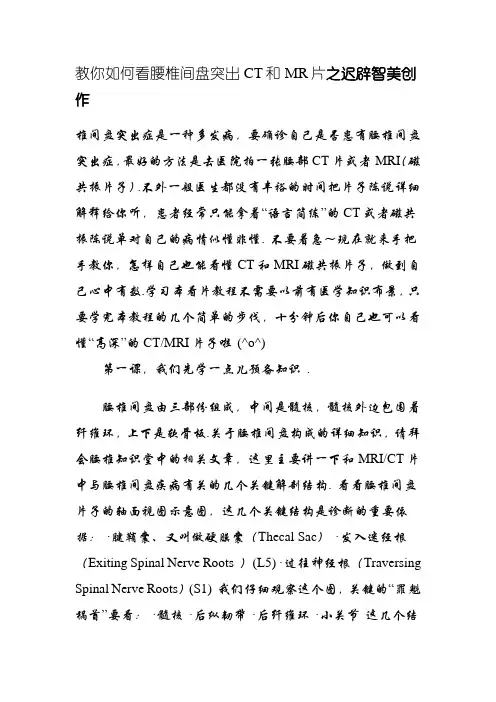 教你如何看腰椎间盘突出CT和MR片