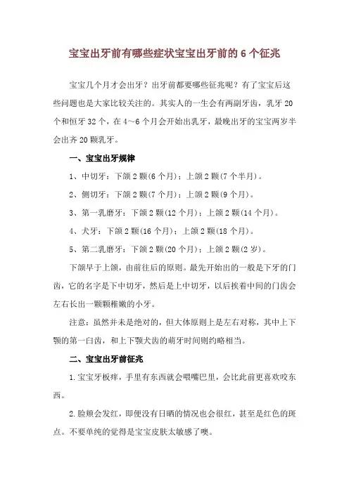 宝宝出牙前有哪些症状 宝宝出牙前的6个征兆