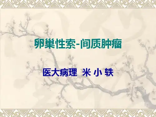 卵巢性索-间质肿瘤
