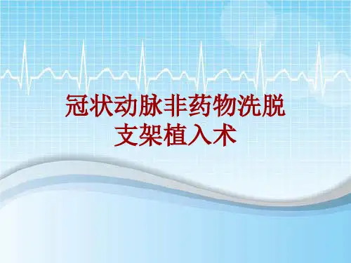 手术讲解模板：冠状动脉非药物洗脱支架植入术