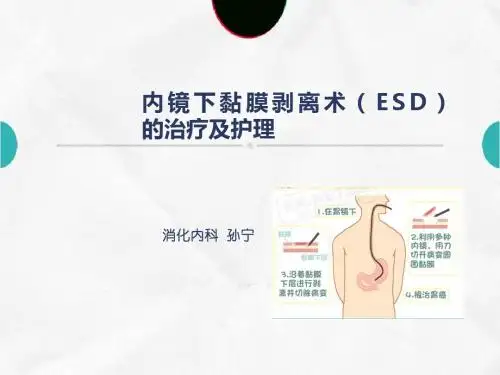 ESD患者的治疗及护理