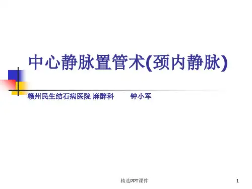中心静脉置管术(颈内静脉)