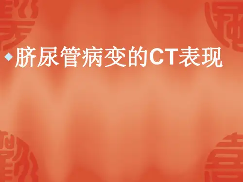医学影像-脐尿管病变的CT表现