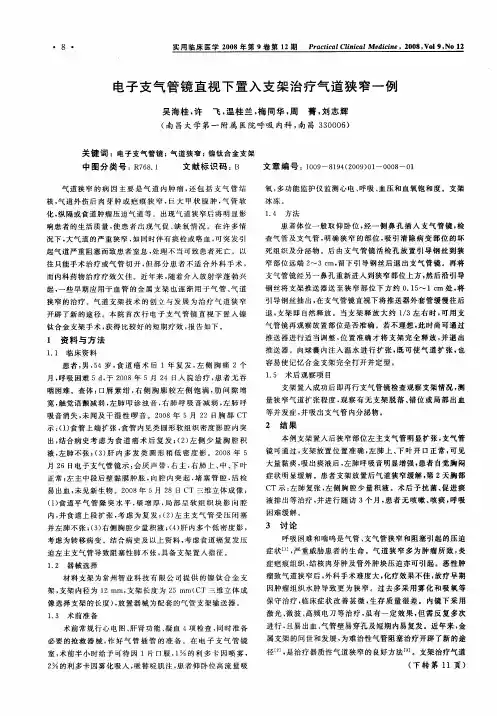 电子支气管镜直视下置入支架治疗气道狭窄一例