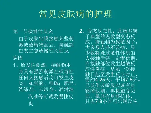 常见皮肤病的护理-(2)ppt课件