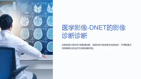 医学影像-DNET的影像诊断诊断