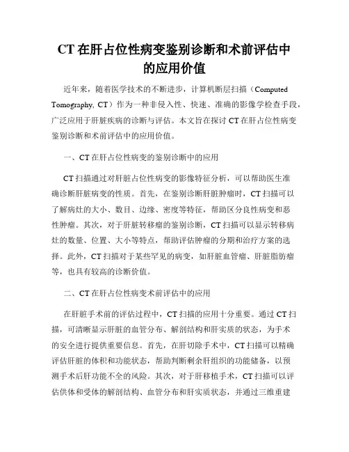 CT在肝占位性病变鉴别诊断和术前评估中的应用价值