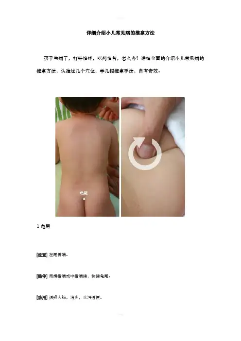 详细介绍小儿常见病的推拿方法