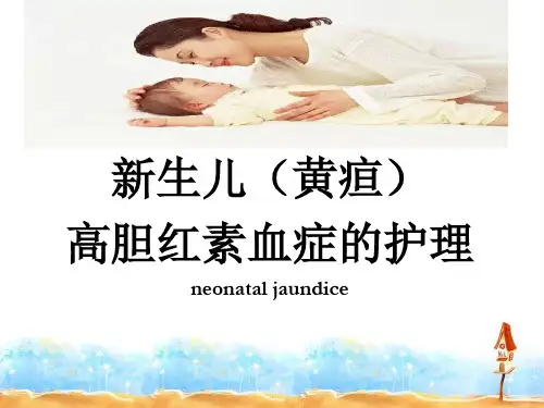 新生科-新生儿高胆红素血症的护理  ppt课件