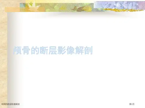 颅骨的断层影像解剖