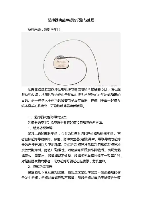 起搏器功能障碍的识别与处理