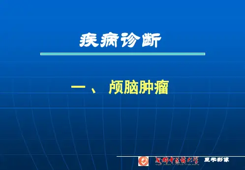影像学中枢神经系统肿瘤