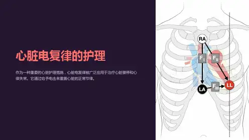 心脏电复律的护理