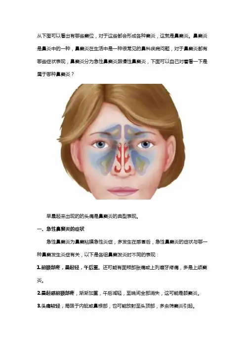 鼻窦炎的症状表现是什么样子？