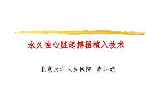 起搏器植入技术ppt课件