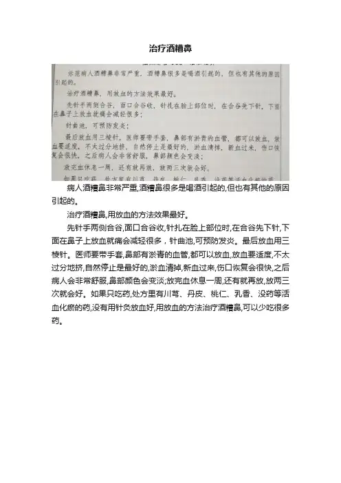 治疗酒糟鼻