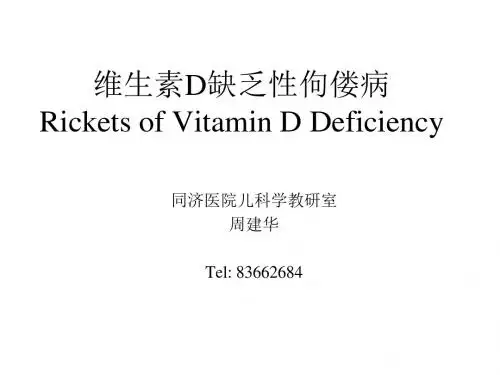 维生素D缺乏性佝偻病Rickets of Vitamin D Deficiency