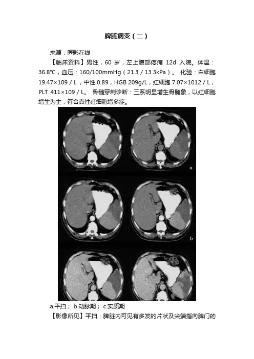 脾脏病变（二）