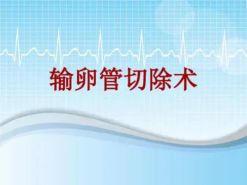 手术讲解模板：输卵管切除术