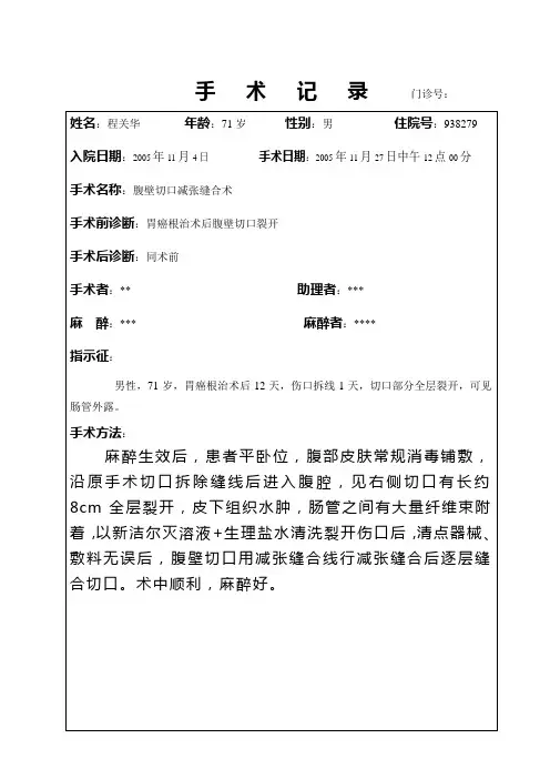 腹壁切口减张缝合