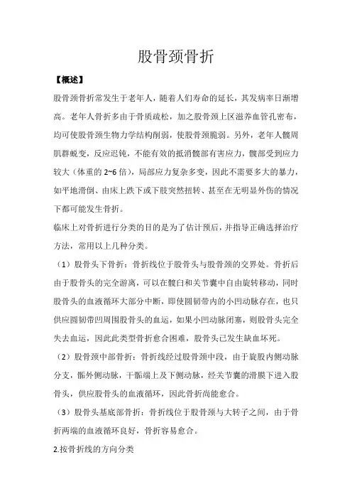 股骨颈骨折诊疗规范