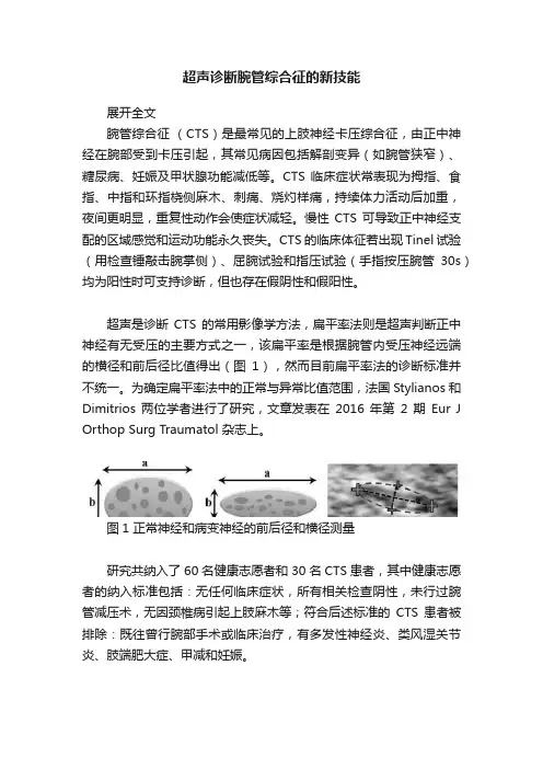 超声诊断腕管综合征的新技能
