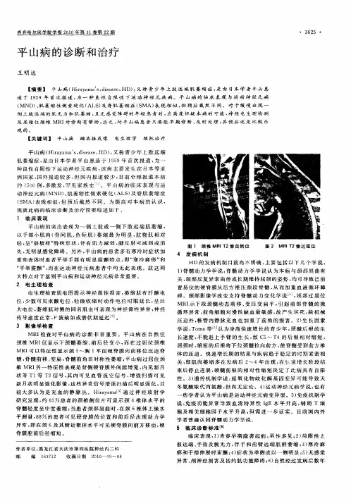 平山病的诊断和治疗