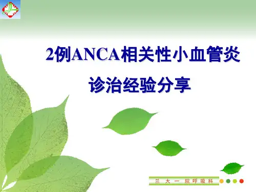 ANCA相关血管炎 ppt课件