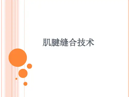 肌腱缝合