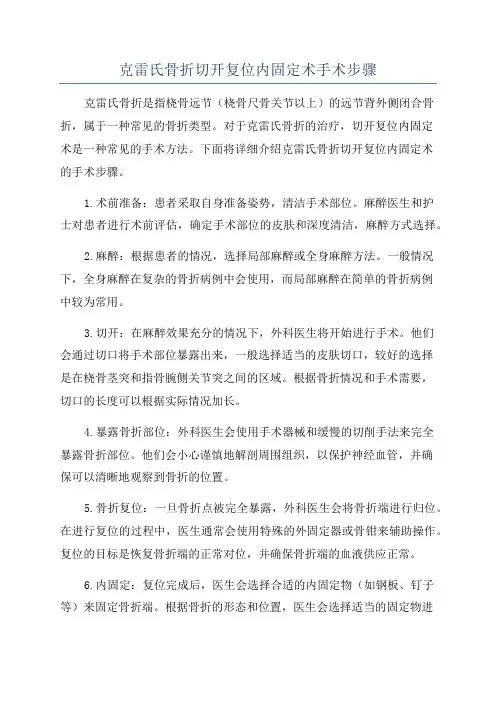 克雷氏骨折切开复位内固定术手术步骤