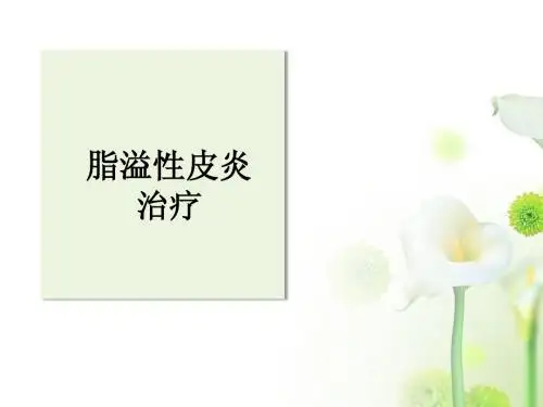 脂溢性皮炎治疗