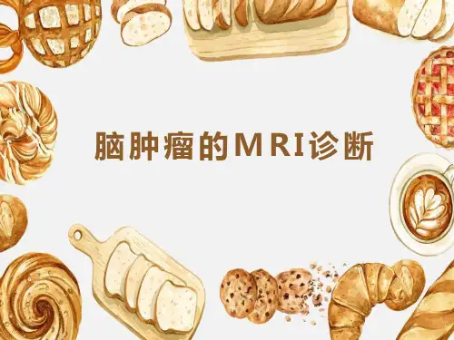 脑内常见肿瘤的MRI诊断