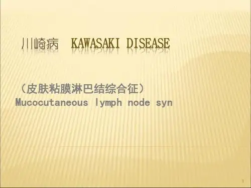 川崎病PPT医学课件