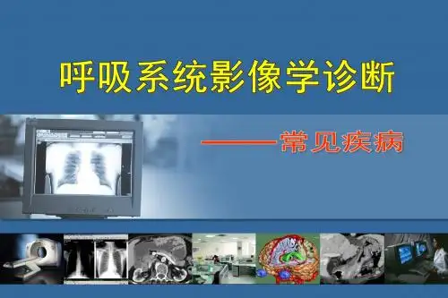 影像诊断呼吸系统PPT课件